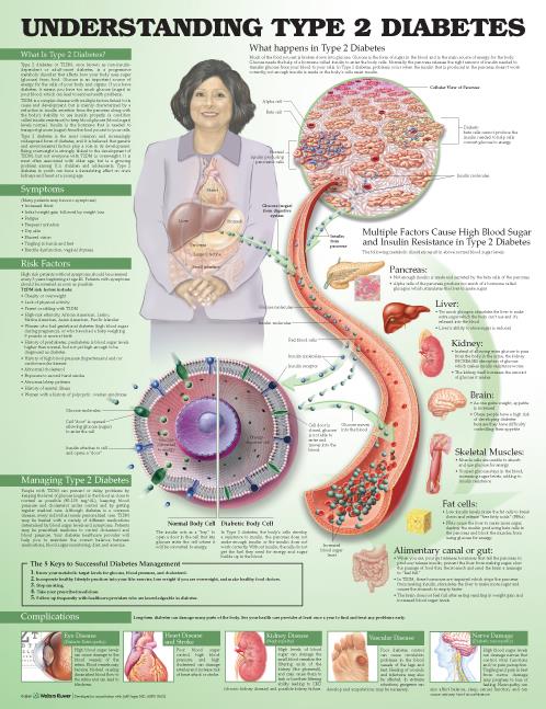 Wolters Kluwer Understanding Diabetes Anatomical Charts 9781469894980 - 1.0 Each