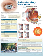Wolters Kluwer Understanding Glaucoma Anatomical Chart 9781496380166 - 1.0 Each