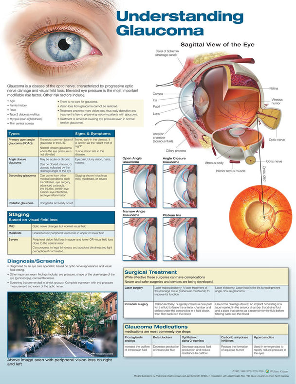 Wolters Kluwer Understanding Glaucoma Anatomical Chart 9781496380166 - 1.0 Each