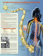 Wolters Kluwer Understanding Multiple Sclerosis Anatomical Chart 9781496394989 - 1.0 Each