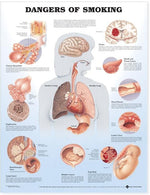Wolters Kluwer Dangers of Smoking Chart 9781587792311 - 1.0 Each