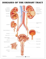Wolters Kluwer Urinary Tract Anatomical Charts 9781587792410 - 1.0 Each