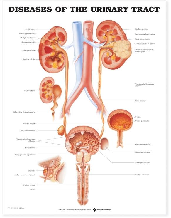 Wolters Kluwer Urinary Tract Anatomical Charts 9781587792427 - 1.0 Each