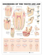 Wolters Kluwer Disorders of the Teeth and Jaw Anatomical Chart, Laminated - 9781587792496 - 1 Each