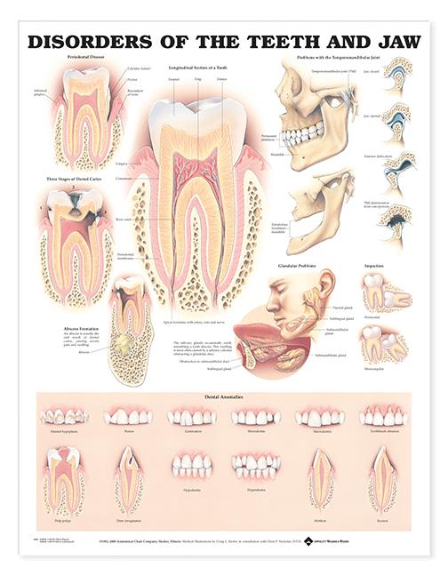 Wolters Kluwer Disorders of the Teeth and Jaw Anatomical Chart, Laminated - 9781587792496 - 1 Each