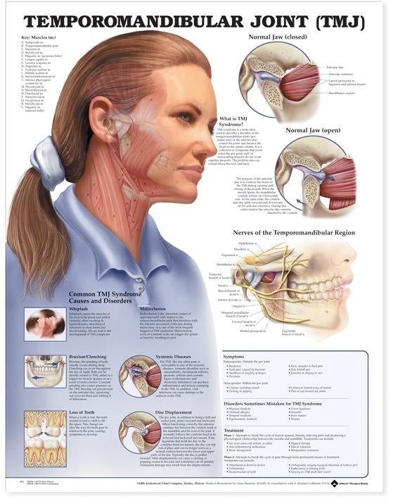 Wolters Kluwer Temporomandibular Joint Anatomical Chart 9781587792960 - 1.0 Each