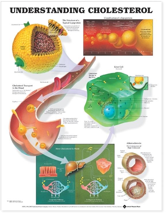 Wolters Kluwer Understanding Cholesterol Anatomical Chart 9781587793264 - 1.0 Each