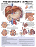 Wolters Kluwer Understanding Hepatitis Anatomical Chart, Paper - WKH1587794179