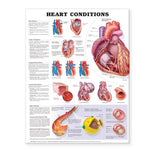 Wolters Kluwer Heart Conditions Anatomical Charts 9781587798825 - 1.0 Each