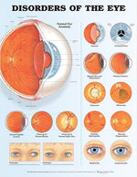 Wolters Kluwer Disorders of the Eye Anatomical Chart, Laminated - 9781587799259 - 1 Each