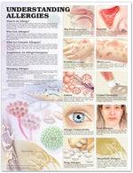 Wolters Kluwer Understanding Allergies Anatomical Chart, Laminated - 9781587799419 - 1 Each
