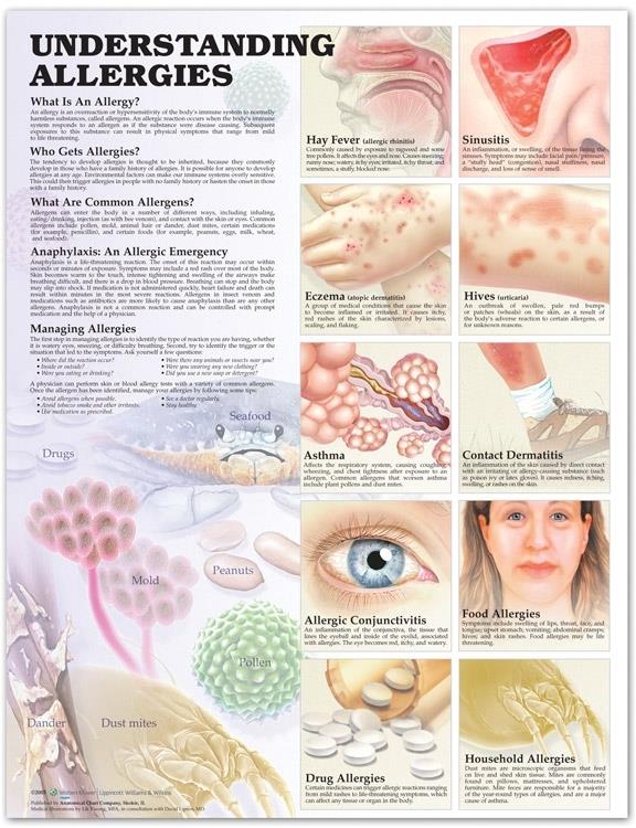 Wolters Kluwer Understanding Allergies Anatomical Chart, Laminated - 9781587799419 - 1 Each