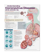 Wolters Kluwer Understanding Coronavirus Disease (COVID-19) Anatomical Chart 9781975170707 - 1.0 Each