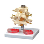Wolters Kluwer Spine Budget Lumbar Vertebrae Model - CH76 - 1 Each