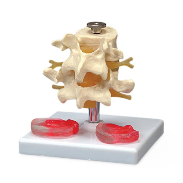 Wolters Kluwer Spine Budget Lumbar Vertebrae Model - CH76 - 1 Each