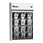 Wolf Trimline X-Ray Illuminator, Single, 14" x 17" - WOL21401