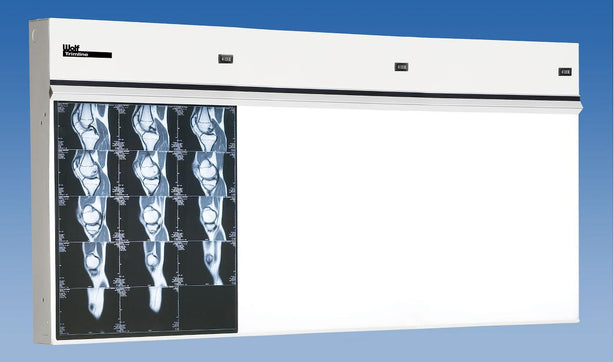 Wolf Trimline X-Ray Illuminator, 3 in 1 Horizontal - WOL21403