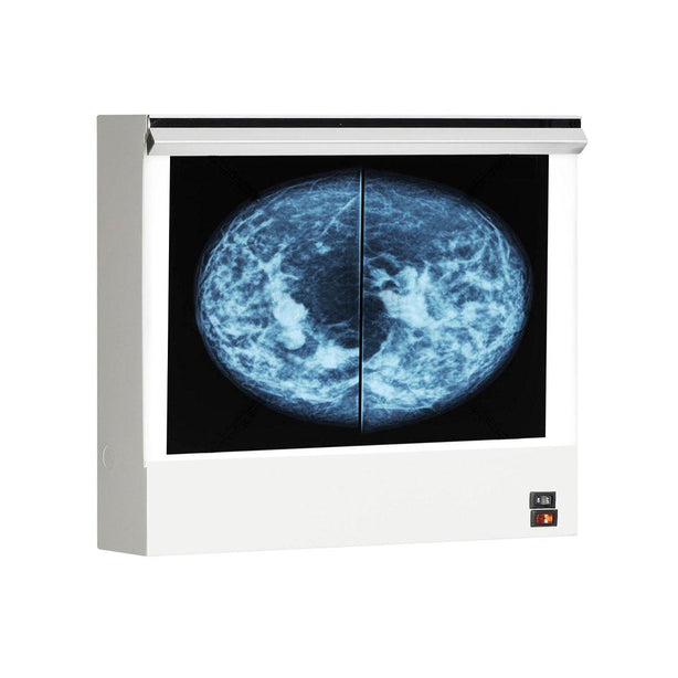 Wolf VuPlus Viewer Mammography X-Ray Illuminator, Single - WOL28001