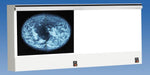 Wolf VuPlus Viewer Mammography X-Ray Illuminator, Double - WOL28002