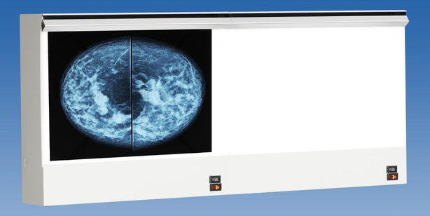 Wolf VuPlus Viewer Mammography X-Ray Illuminator, Double - WOL28002