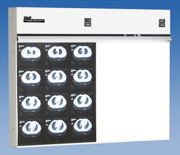Wolf TrimlinePlus HiLo X-ray Trimline Plus Hi-Lo Illuminator, 2 in 1 - WOL29002
