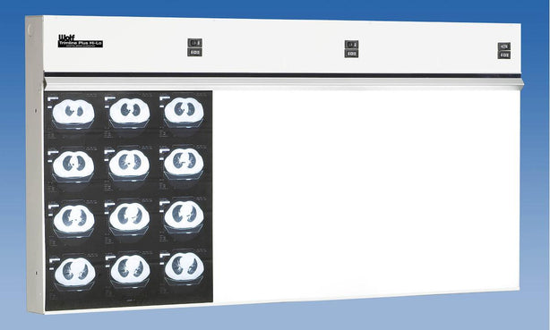 Wolf TrimlinePlus HiLo X-ray Trimline Plus Hi-Lo Illuminator, 3 in 1 - WOL29003