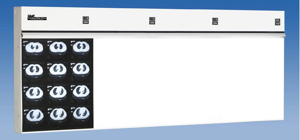 Wolf TrimlinePlus HiLo X-ray Trimline Plus Hi-Lo Illuminator, 4 in 1 - WOL29004
