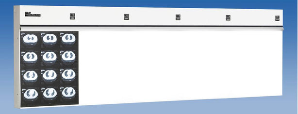 Wolf X-Ray TrimlinePlus HiLo Illuminators - WOL29005