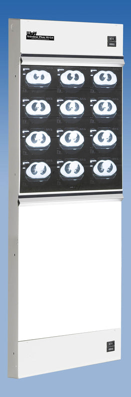 Wolf TrimlinePlus HiLo X-ray Trimline Plus Hi-Lo Illuminator, 1 Over 1 - WOL29011