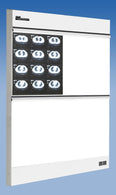 Wolf TrimlinePlus HiLo X-ray Trimline Plus Hi-Lo Illuminator, 2 Over 2 - WOL29022