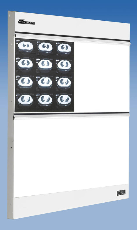 Wolf TrimlinePlus HiLo X-ray Trimline Plus Hi-Lo Illuminator, 2 Over 2 - WOL29022