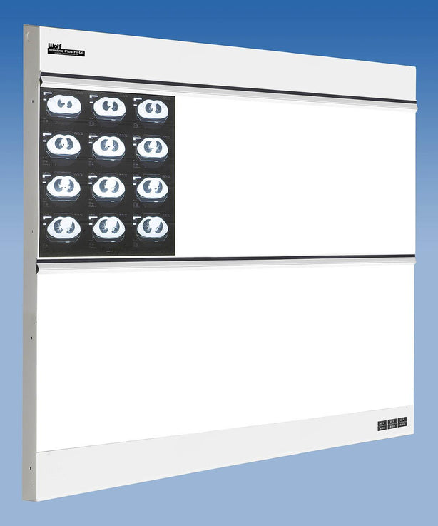 Wolf TrimlinePlus HiLo X-ray Trimline Plus Hi-Lo Illuminator, 3 Over 3 - WOL29033