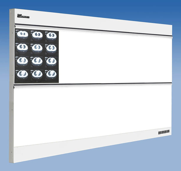 Wolf TrimlinePlus HiLo X-ray Trimline Plus Hi-Lo Illuminator, 4 Over 4 - WOL29044
