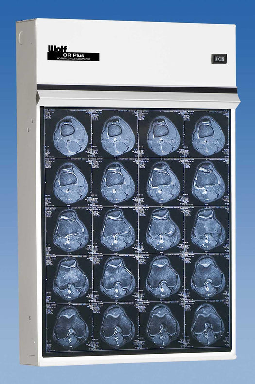 Wolf X-ray Trimline Plus Illuminator, Single - WOL29401