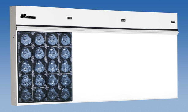 Wolf X-Ray Trimline Plus Illuminators - WOL29403