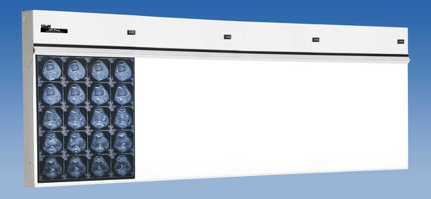Wolf X-ray Trimline Plus Illuminator, 4 in 1 - WOL29404