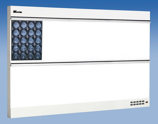 Wolf X-ray Trimline Plus Illuminator, 5 Over 5 - WOL29455