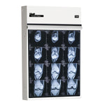 WOLF X-RAY Trimline Basic Illuminators 29501 1 Each - MDL-WOL29501