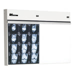 WOLF X-RAY Trimline Basic Illuminators 29502 1 Each - MDL-WOL29502
