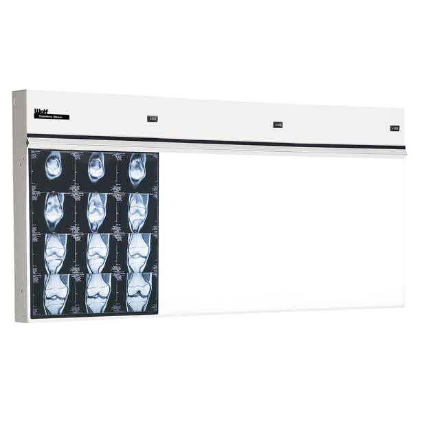 WOLF X-RAY Trimline Basic Illuminators 29503 1 Each - MDL-WOL29503