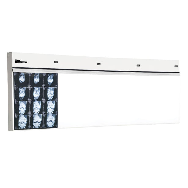 WOLF X-RAY Trimline Basic Illuminators 29504 1 Each - MDL-WOL29504