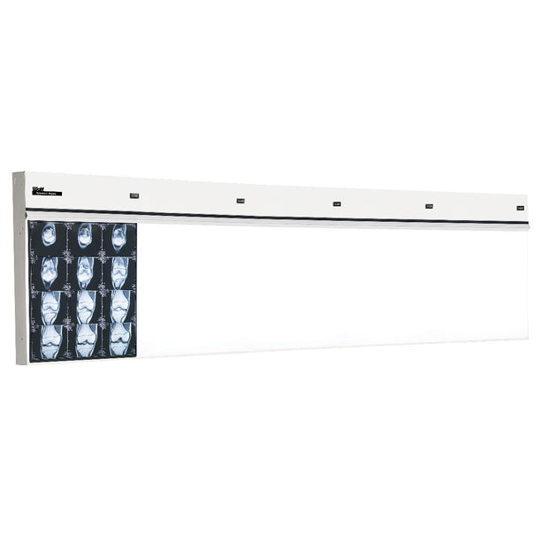 WOLF X-RAY Trimline Basic Illuminators 29505 1 Each - MDL-WOL29505