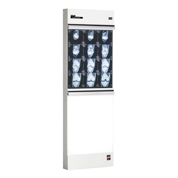 WOLF X-RAY Trimline Basic Illuminators 29511 1 Each - MDL-WOL29511