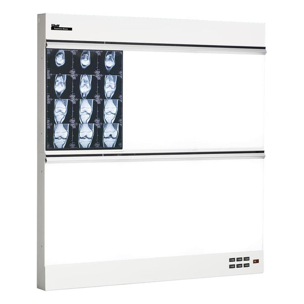 WOLF X-RAY Trimline Basic Illuminators 29533 1 Each - MDL-WOL29533