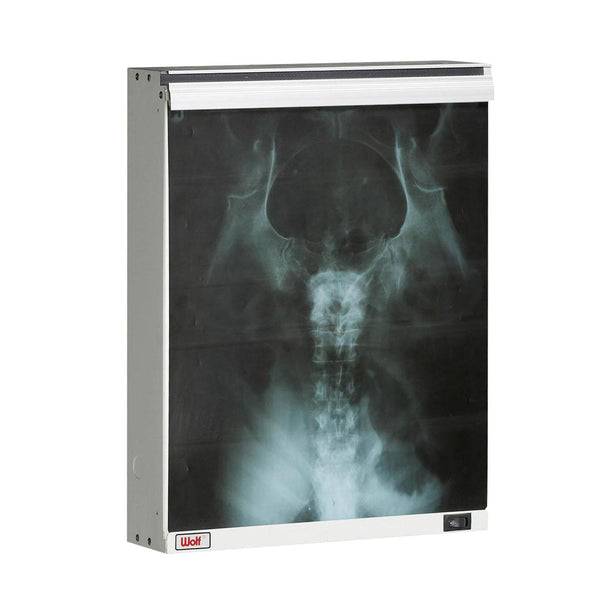 Wolf The X-Ray Econoline Illuminator, Single - WOL29601