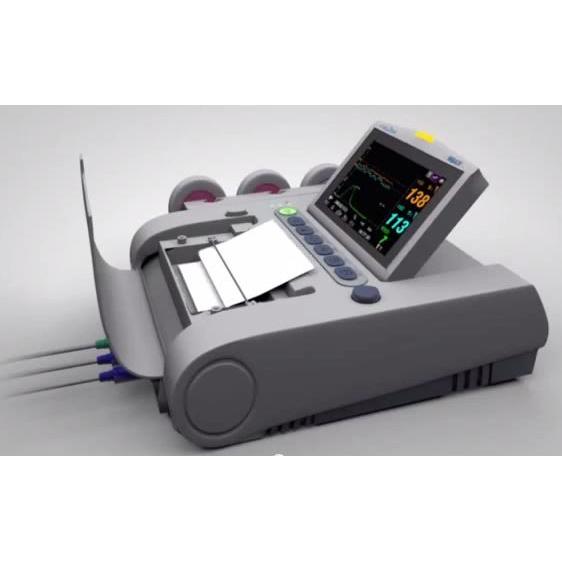 Fetal2EMR Monitor Thermo Paper, 90/152 mm, Fetal Monitoring Systems - 902304 - 3 Each