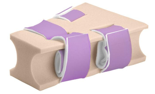 Xodus Medical Xodus Medical Bariatric Abduction Pillows 40497 - 6.0 Each